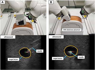 Design and validation of a medical robotic device system to control two collaborative robots for ultrasound-guided needle insertions